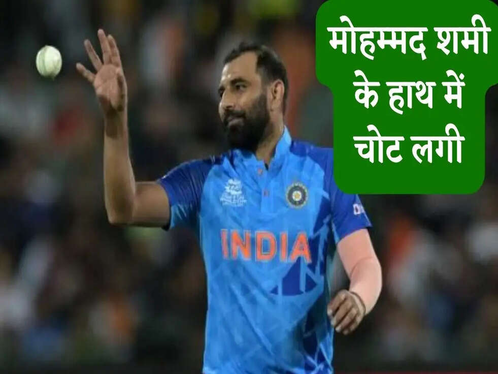  मोहम्मद शमी के हाथ में चोट लगी