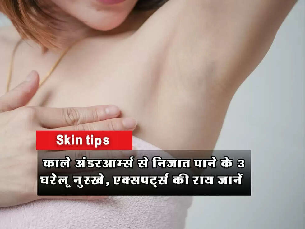 Skin tips : काले अंडरआर्म्स से निजात पाने के 3 घरेलू नुस्खे, एक्सपर्ट्स की राय जानें