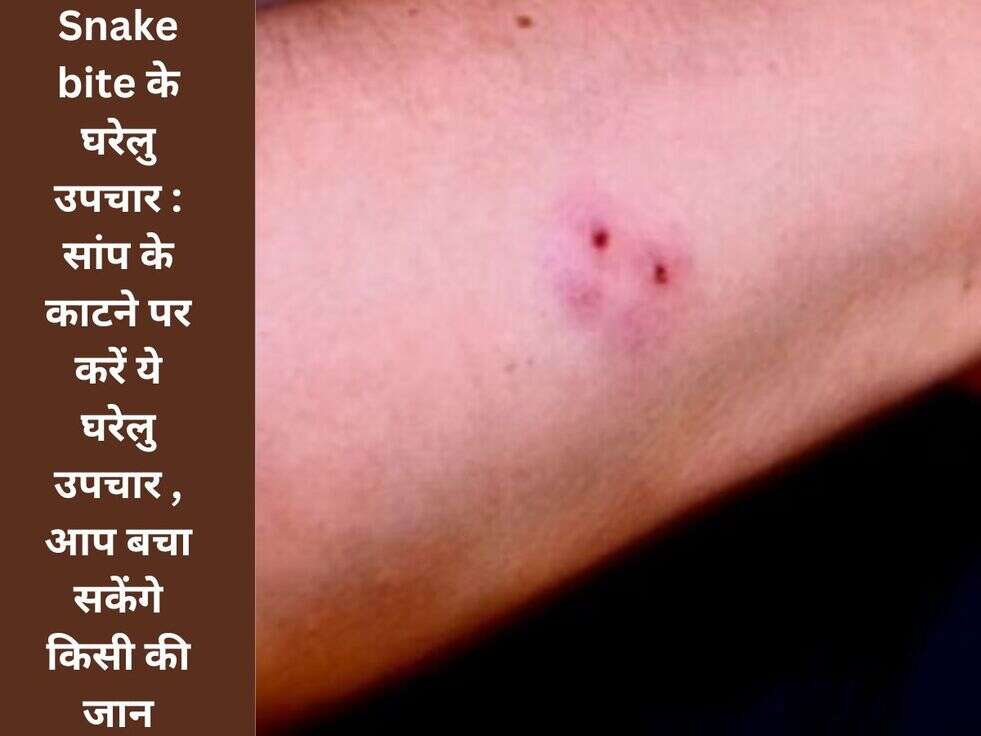 snake bite