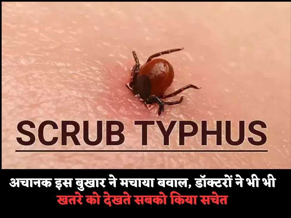 अचानक इस बुखार ने मचाया&nbsp;बवाल, डॉक्टरों ने भी भी खतरे को देखते सबको किया सचेत