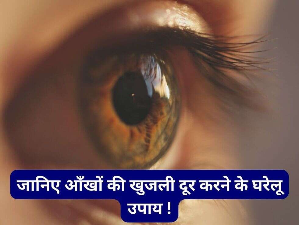जानिए आँखों की खुजली दूर करने के घरेलू उपाय !