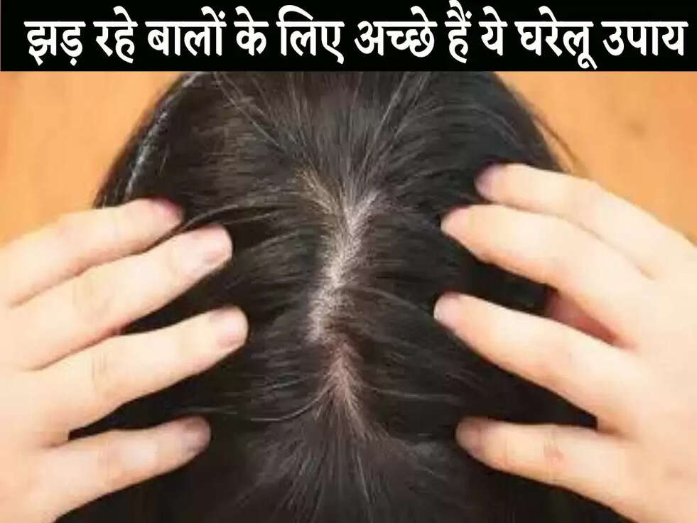 Hairs Tips: झड़ रहे बालों के लिए अच्छे हैं ये घरेलू उपाय, जानिए&nbsp;