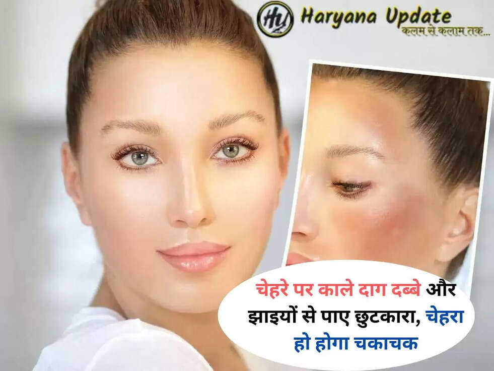 Pigmentation Treatment