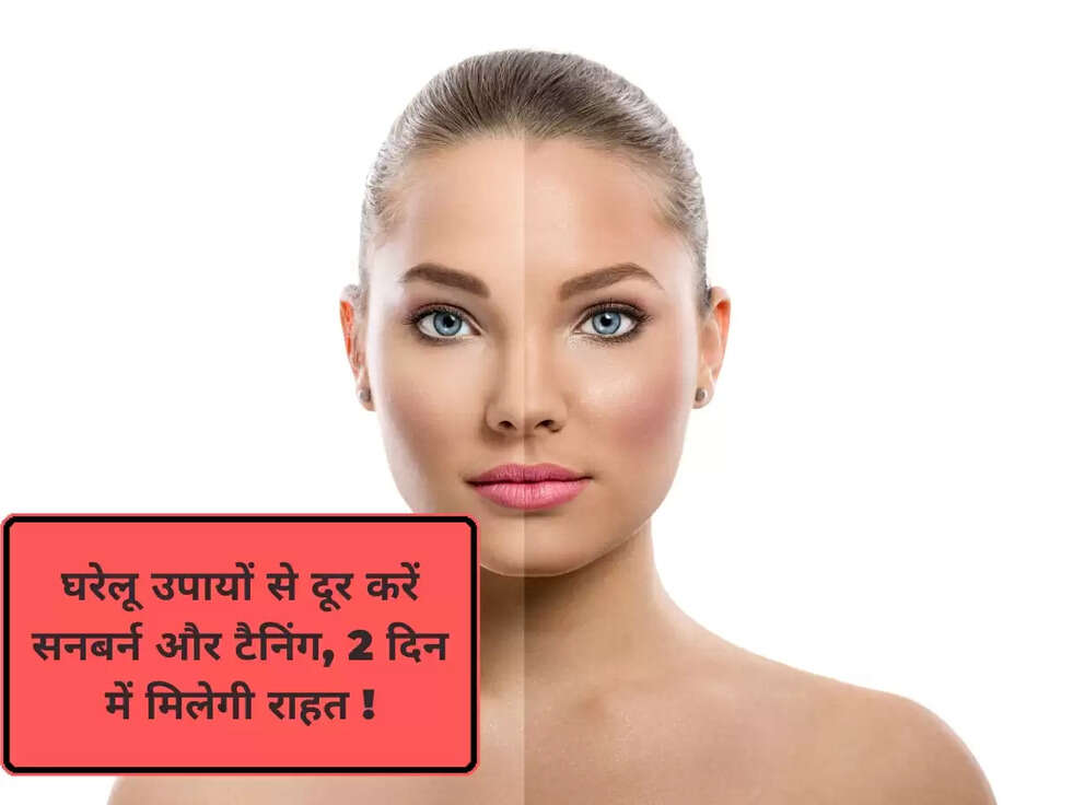 घरेलू उपायों से दूर करें सनबर्न और टैनिंग, 2 दिन में मिलेगी राहत !