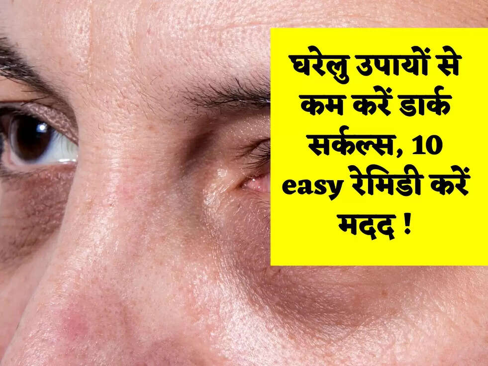 घरेलु उपायों से कम करें डार्क सर्कल्स, 10 easy रेमिडी करें मदद !