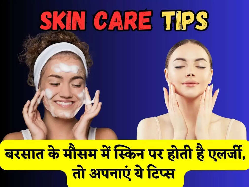 Skin Care Tips: बरसात के मौसम में स्किन पर होती है एलर्जी, तो अपनाएं ये टिप्स 