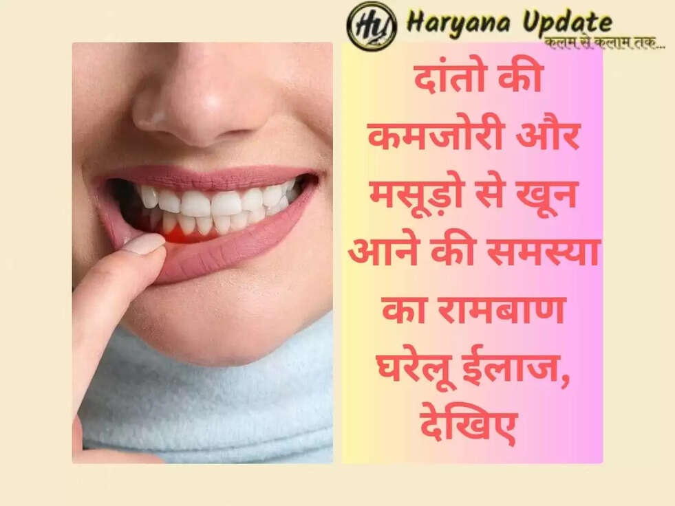  दांतो की कमजोरी और मसूड़ो से खून आने की समस्या का रामबाण घरेलू ईलाज, देखिए 