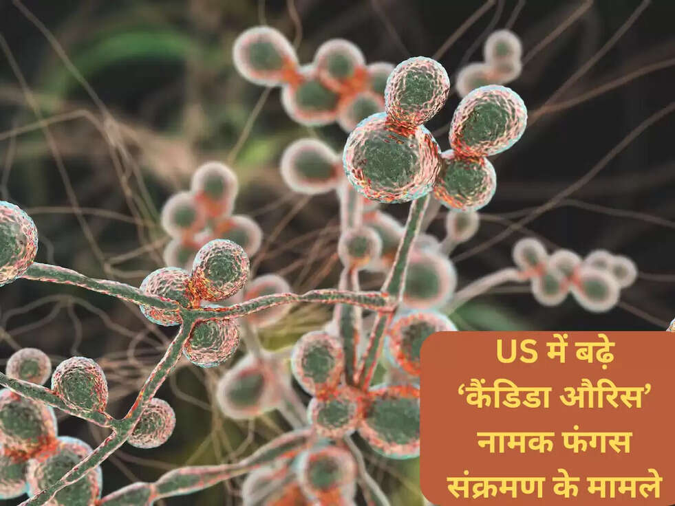 US में बढ़े&nbsp;&lsquo;कैंडिडा औरिस&rsquo; नामक फंगस&nbsp;संक्रमण &nbsp;के मामले
