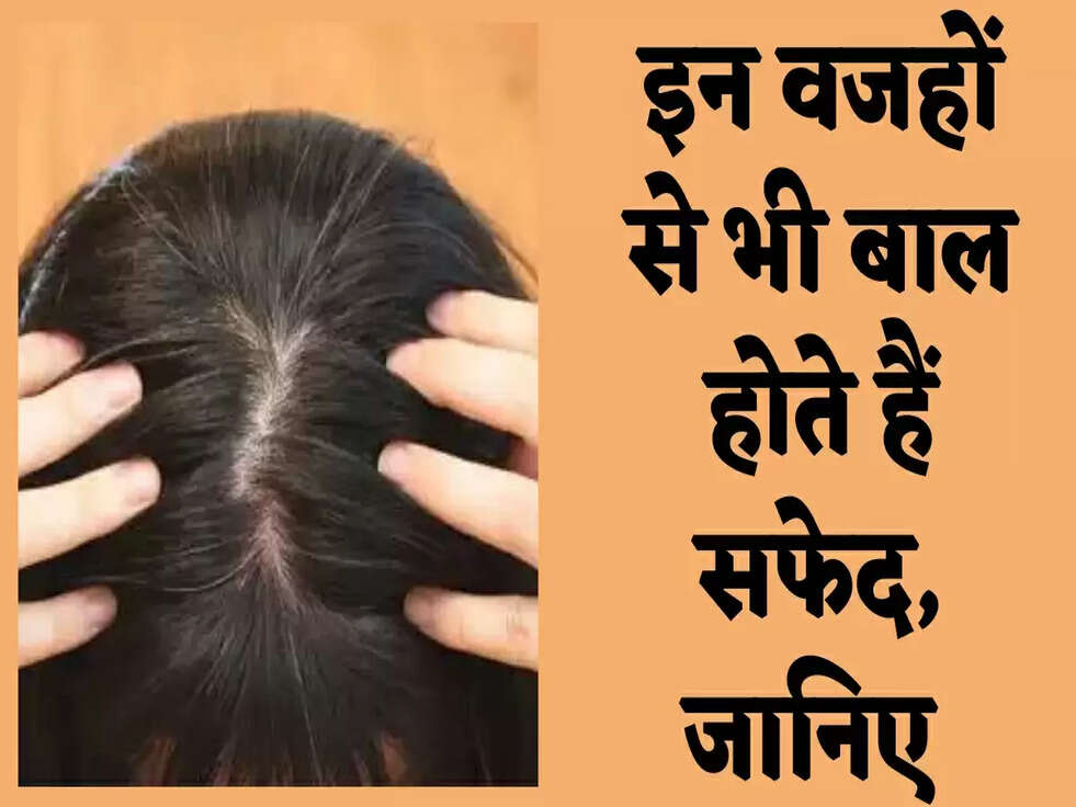 White Hair: इन वजहों से भी बाल होते हैं सफेद, जानिए&nbsp;